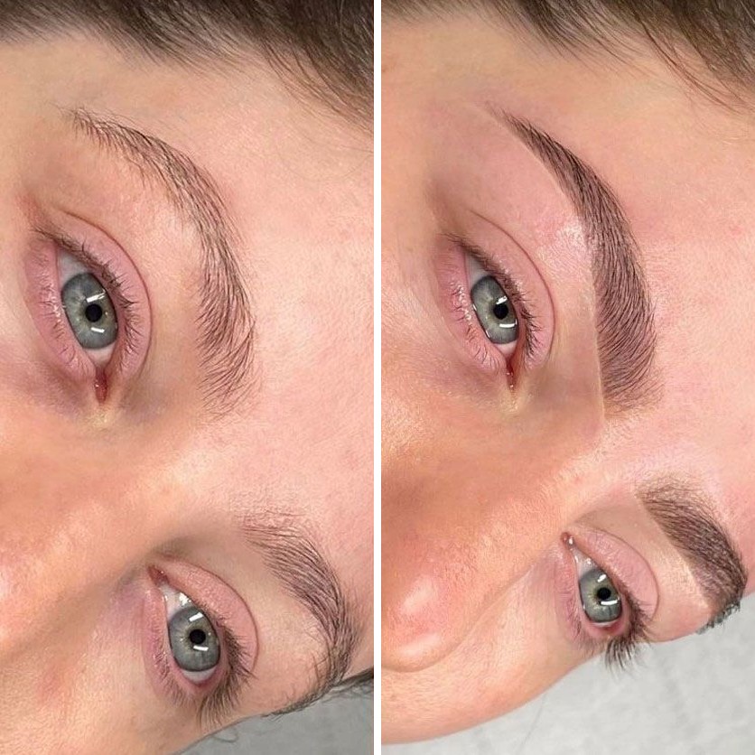 Natural Brow Restoration